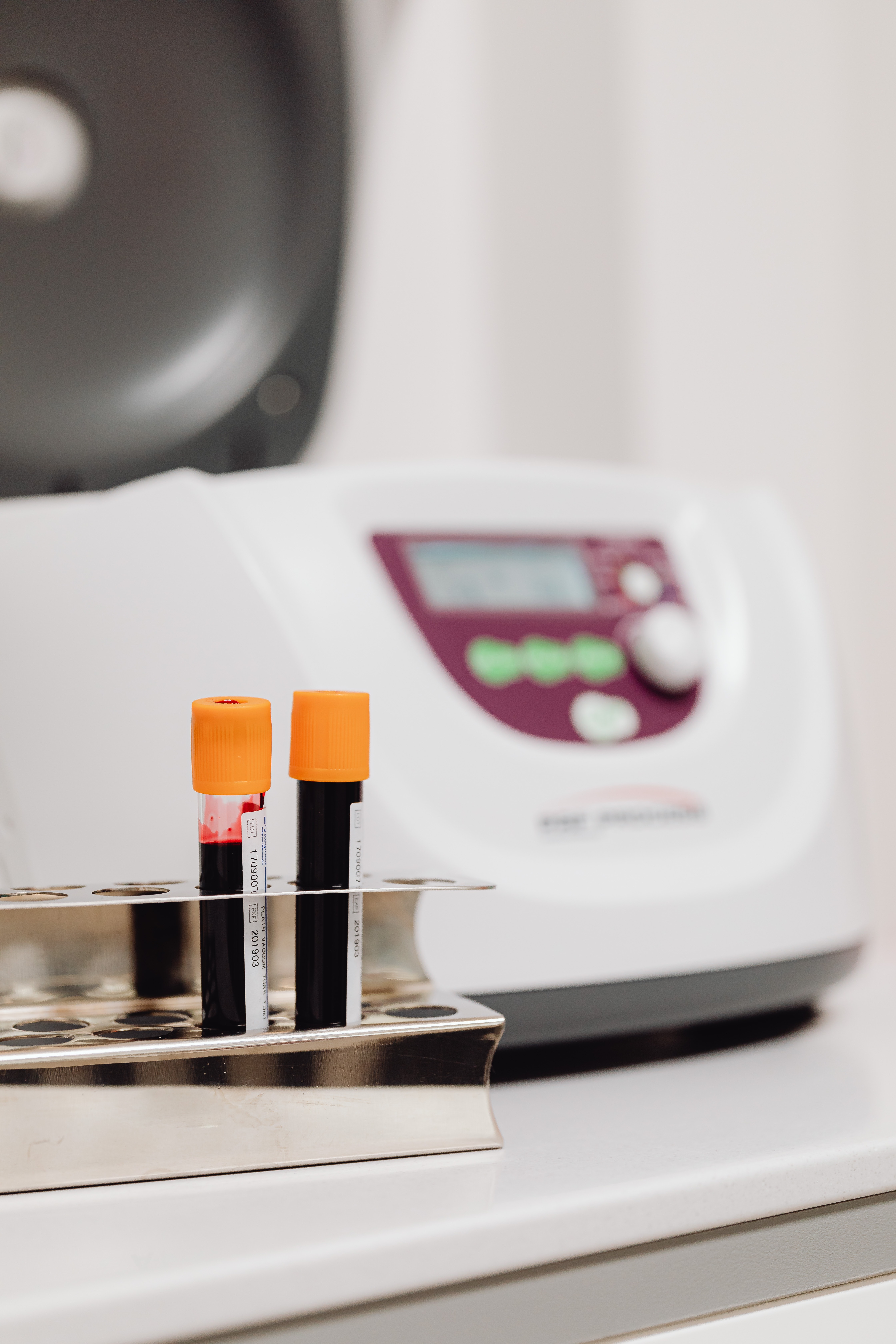 2 Vacutainer blood tubes on a sample rack